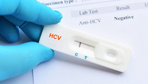 Jaunnedēļ Daugavpilī bez maksas varēs veikt C hepatīta eksprestestu