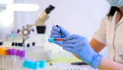Centrālā laboratorija piedāvā jaunu ģenētisku testu