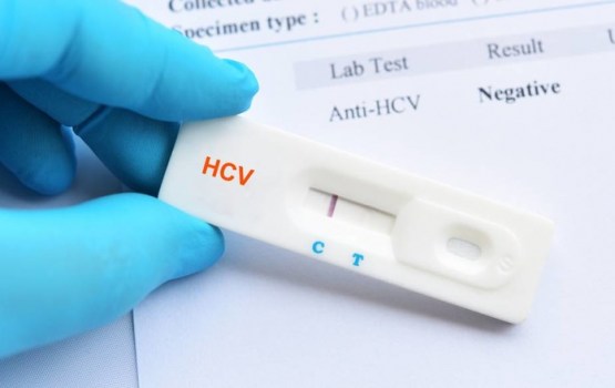Jaunnedēļ Daugavpilī bez maksas varēs veikt C hepatīta eksprestestu