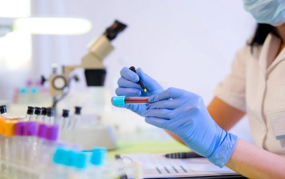 Centrālā laboratorija piedāvā jaunu ģenētisku testu